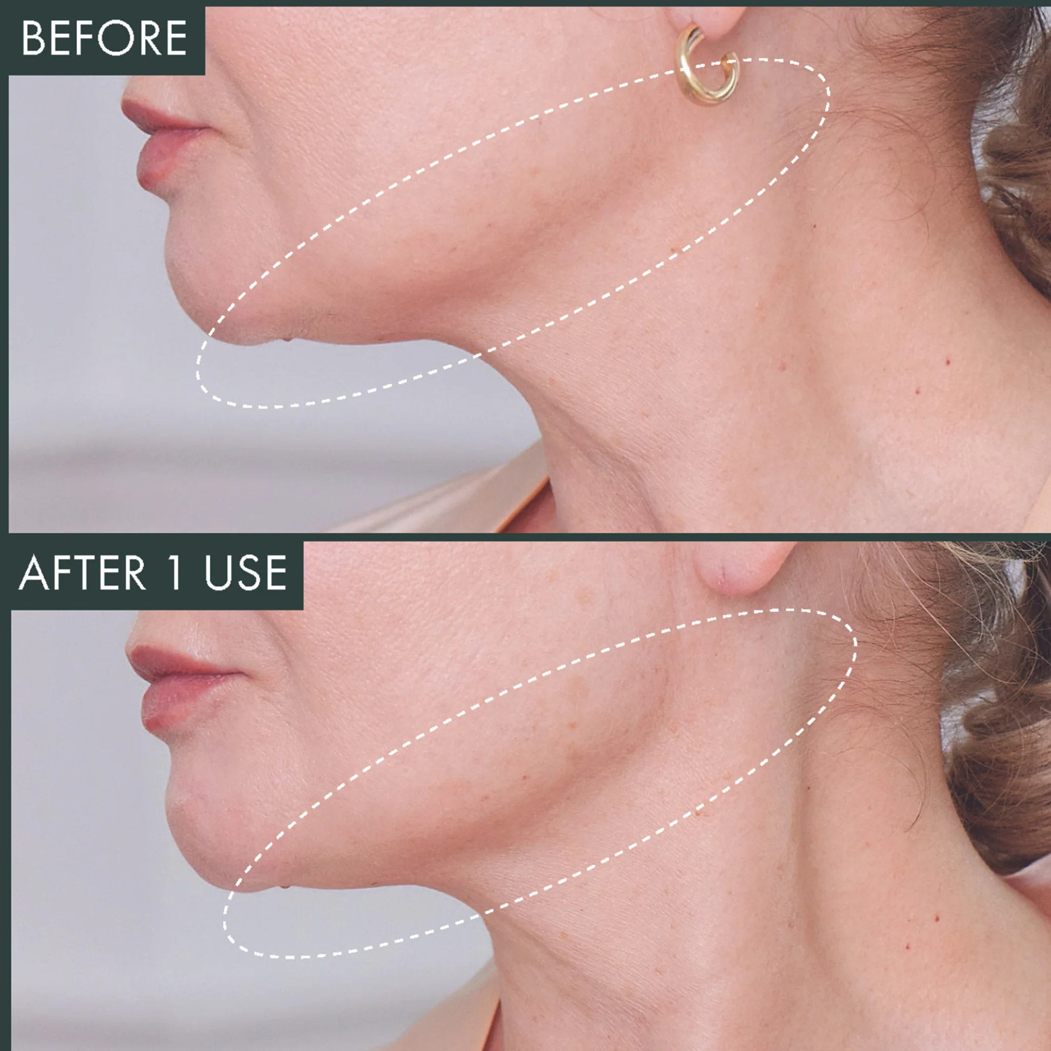 Fermitif Chin Contour / Instant Tightening Peptide Mask - Image 4