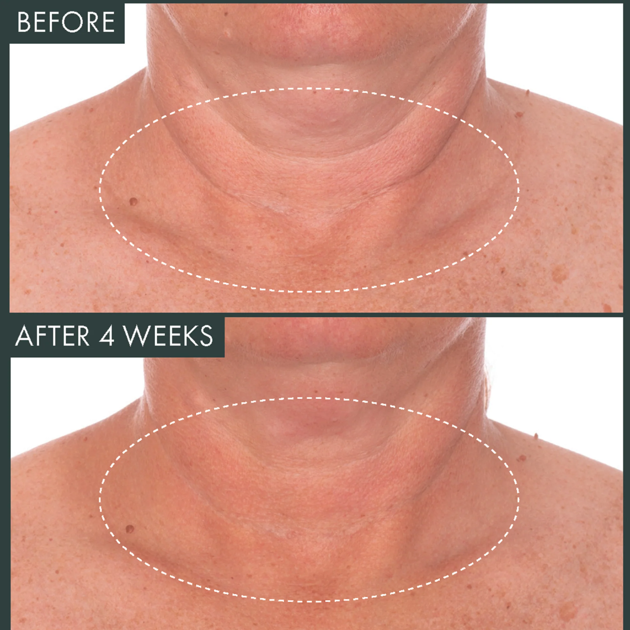 Fermitif Neck Renewal Night Cream / Firming Moisturizer - Image 3