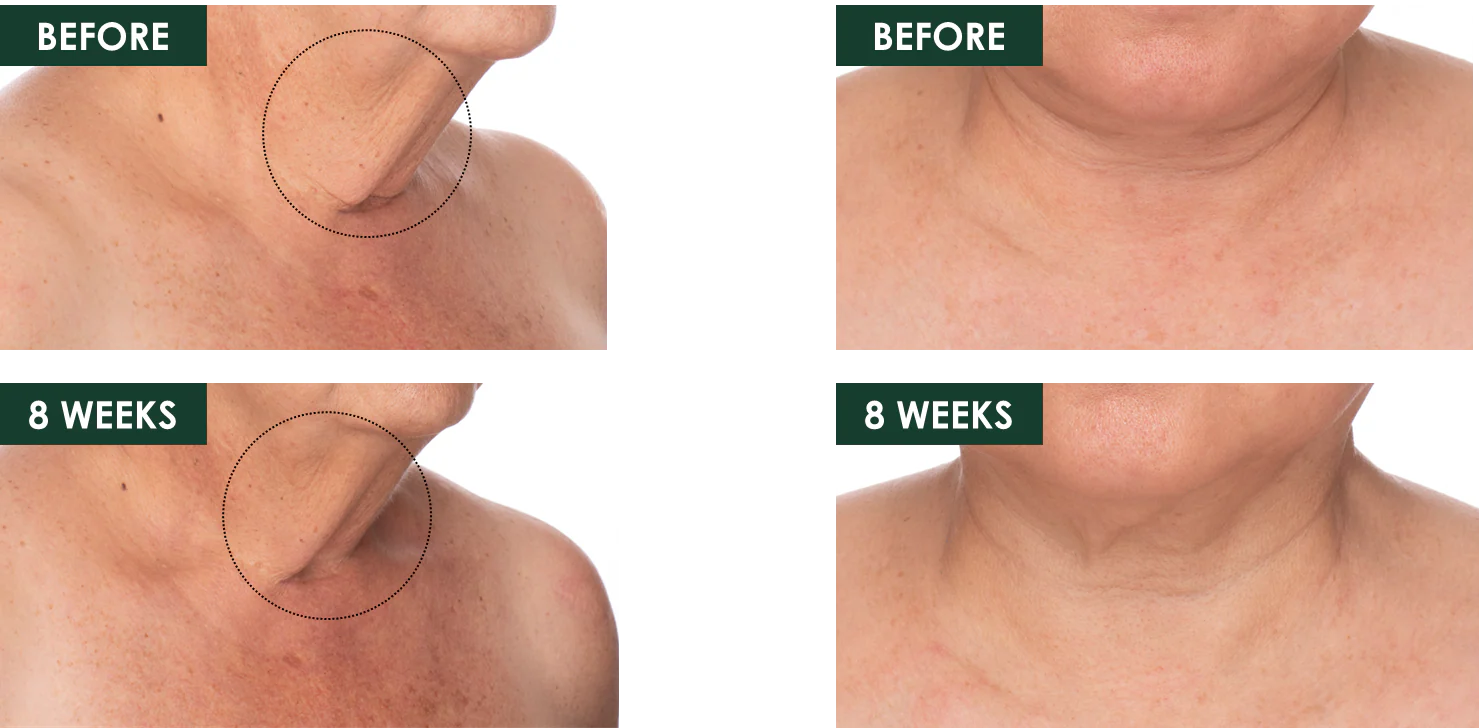 Fermitif Neck Renewal Serum / Firming Treatment - Image 3