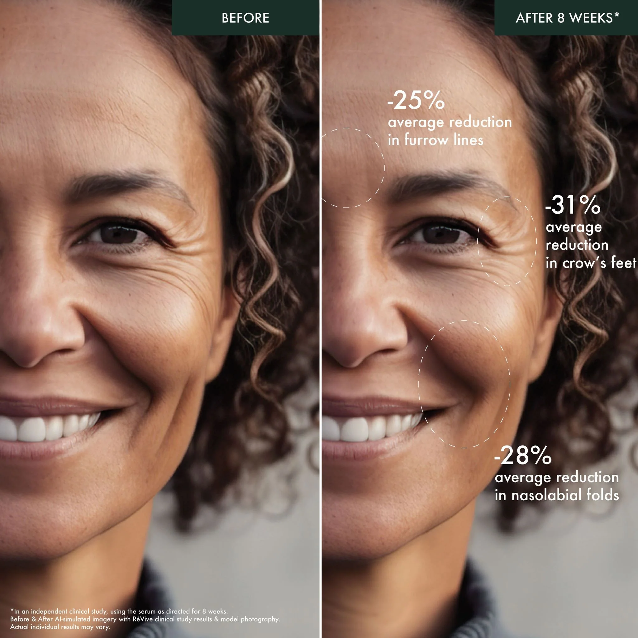 Intensité/ VOLUMIZING SERUM® Ultime / Targeted Skin Filler - Image 3