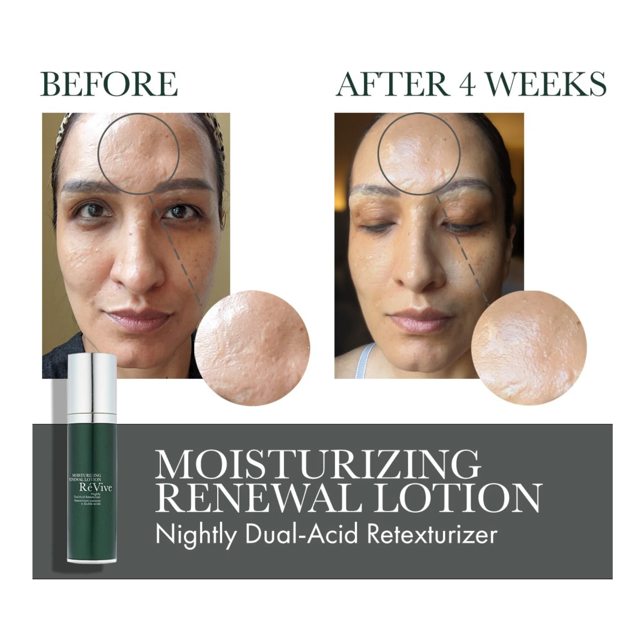 Moisturizing Renewal Lotion/ Nightly Dual-Acid Retexturizer - Image 3