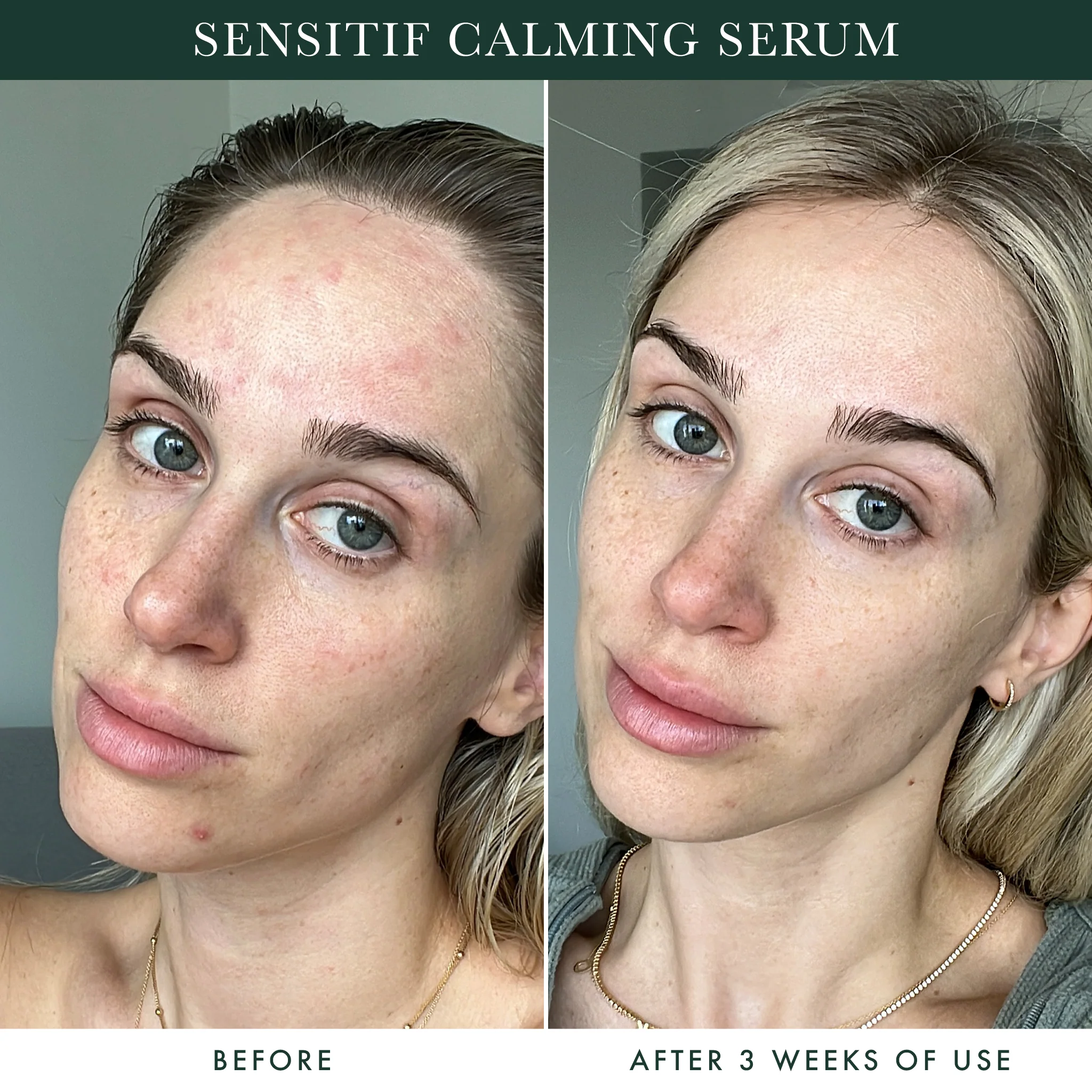 Sensitif Calming Serum / Skin Barrier Repair - Image 4